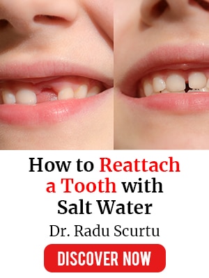 Survival MD - How to Reattach a Tooth with Salt Water